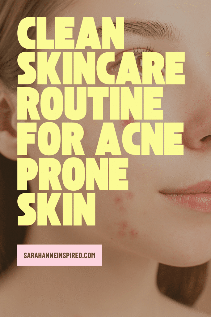 adult acne, adult acne treatment, skincare routine for acne, skincare for acne, skincare routine for acne prone skin